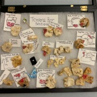 Shadow Box of Temporal Bone Sections